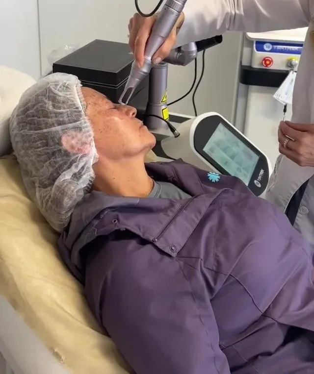 Laser treatment in the office